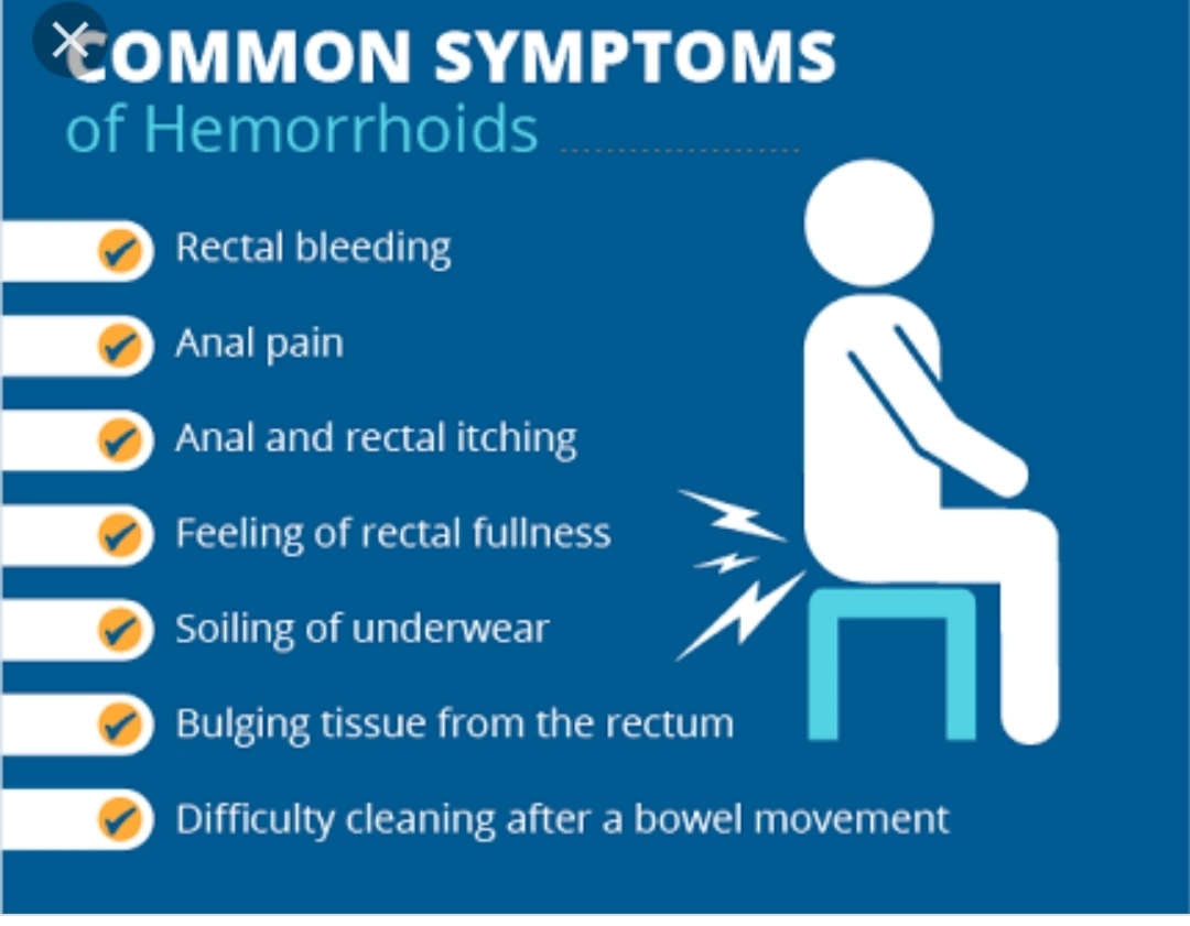 Haemorrhoids Piles Symptoms, Types, Causes & Treatment Santripty