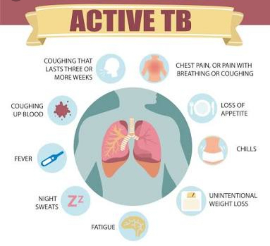 Tuberculosis Among the top 10 causes of death globally Santripty