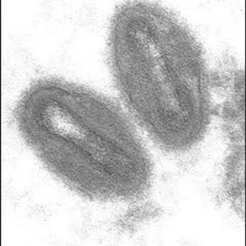 Picture representation of monkeypox virus 