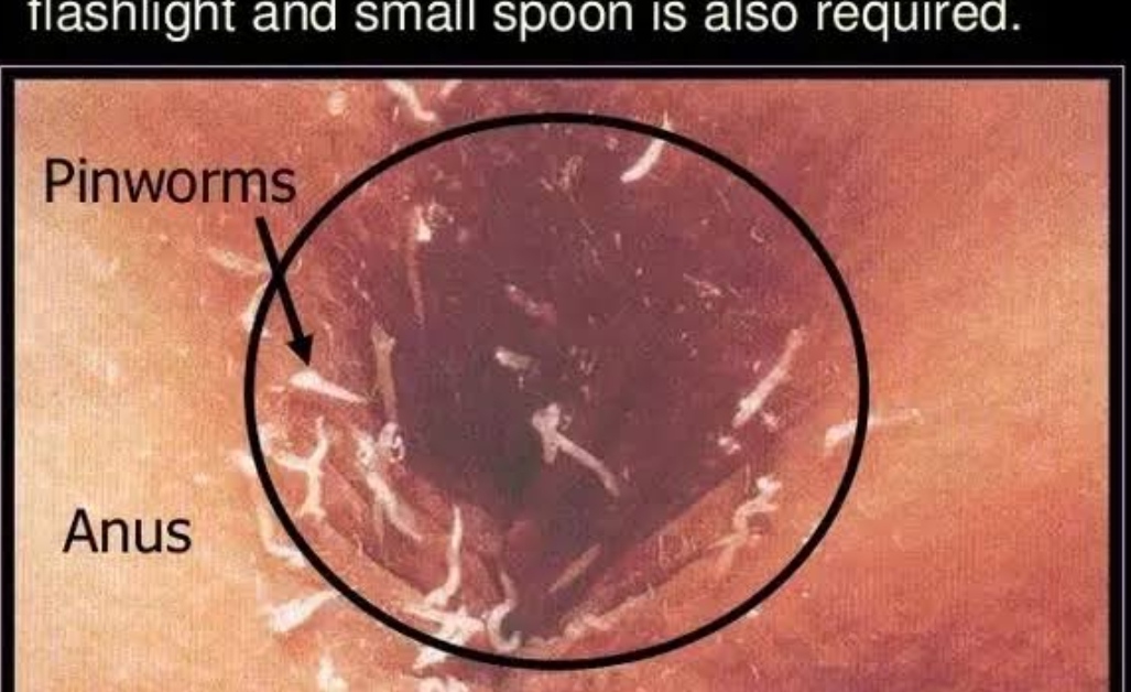 stapled vagina