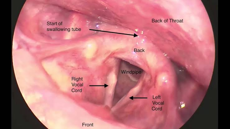 Larynx Anatomy 