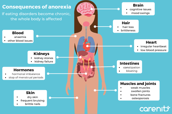 Visible symptoms of anorexia nervosa 