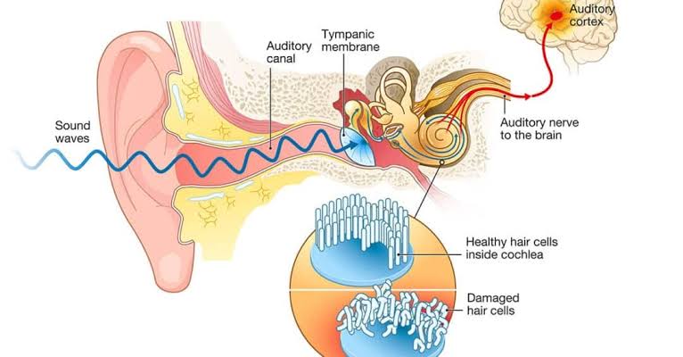 Cause of tinnitus 