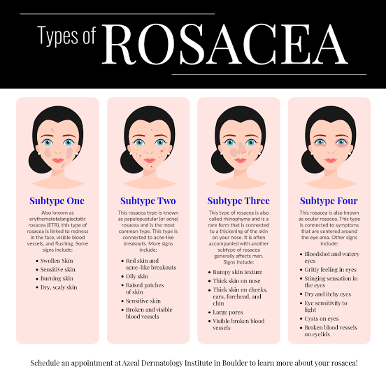 Types of rosacea 