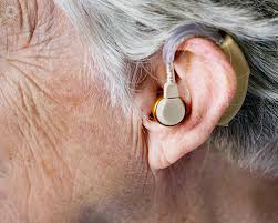 Treatment for hearing loss 