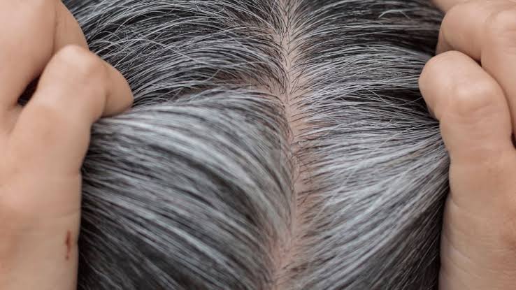 Anu taila helps treating premature greying of hair