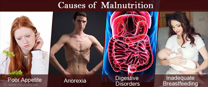 Causes of malnutrition 