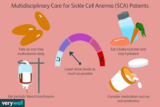 Sickle cell anemia treatment 