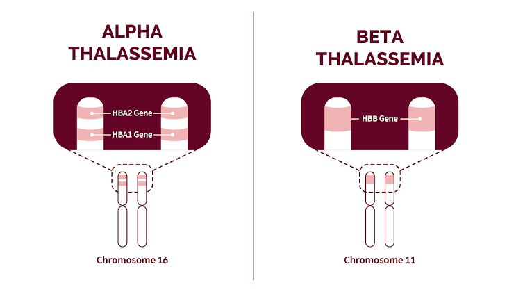 Types of thalassemia 