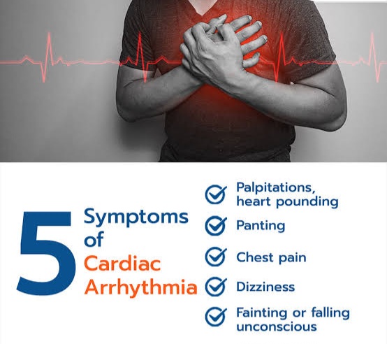 Symptoms of cardiac arrhythmia 