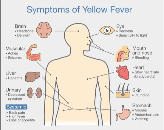 Symptoms of Yellow fever 
