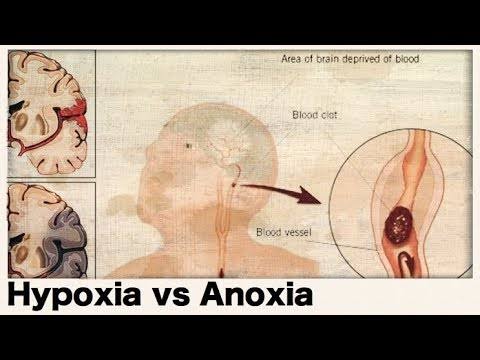 Hypoxia and anoxia causes