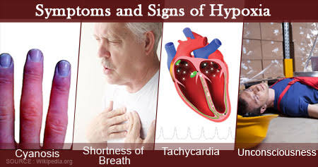 Hypoxia and anoxia different in symptoms 