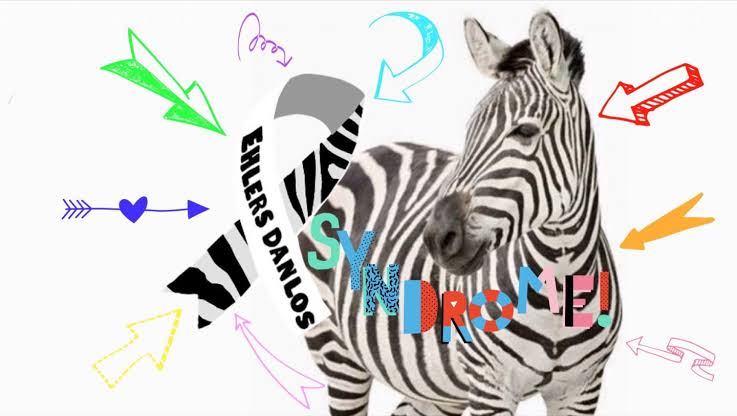 Zebra taken as sign of Ehlers-Danlos syndrome 