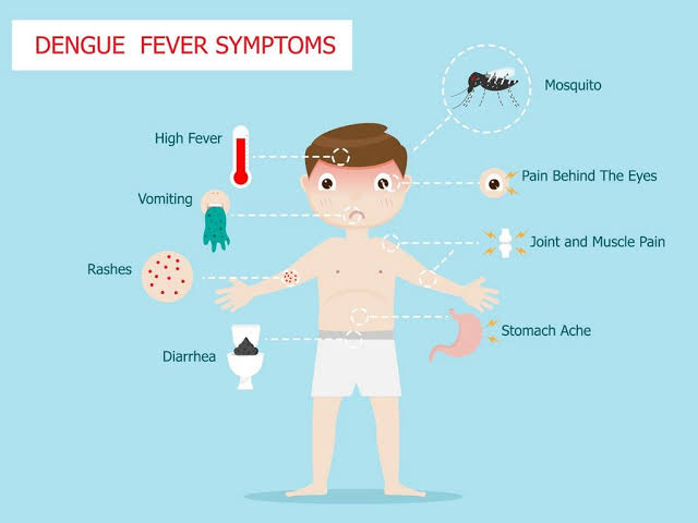 Symptoms of dengue in Children 