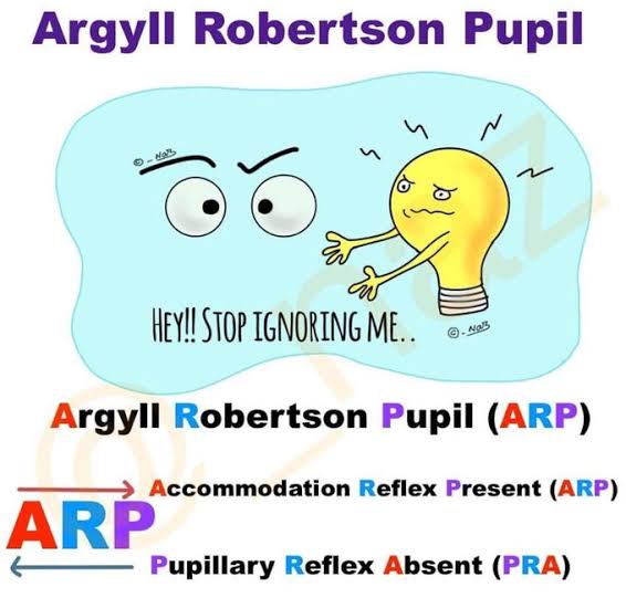 Argyll Robertson Pupil 