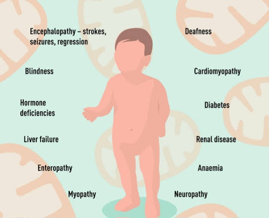 Symptoms of Leigh's disease 