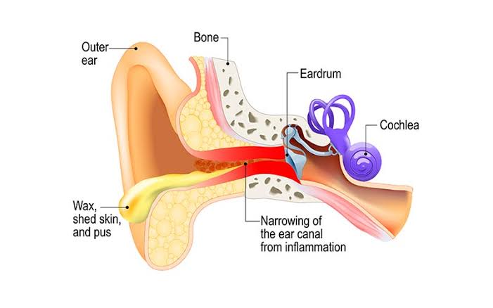 Pathophysiology of swimmer's ear 