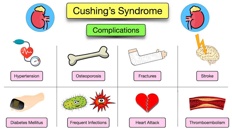 Cushing syndrome complications 