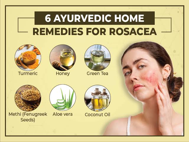 Some Homeremedies in Ayurvedic treatment for rosacea 