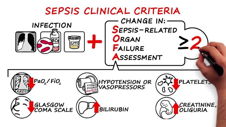 Sepsis vs septic shock understanding with clinical features 